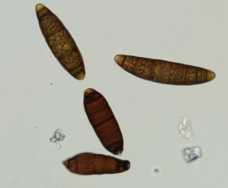 macrostoma