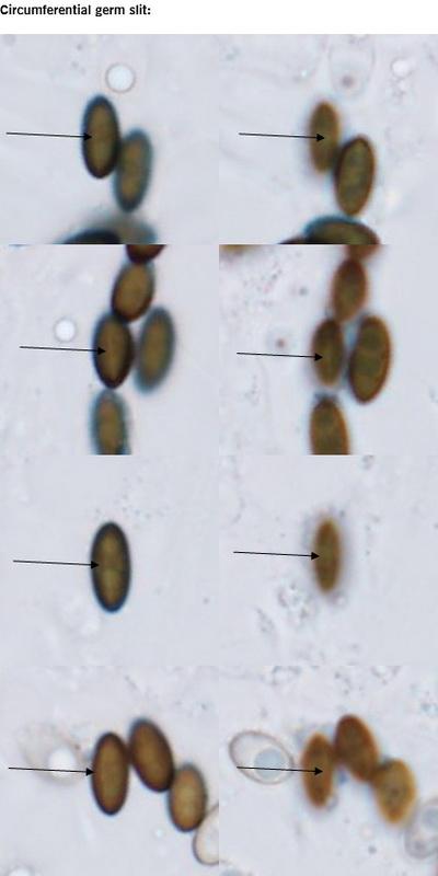 macrostoma