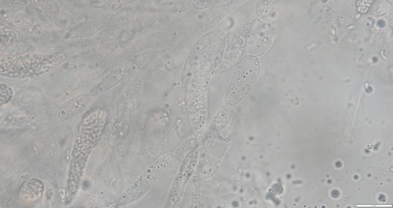 macrostoma
