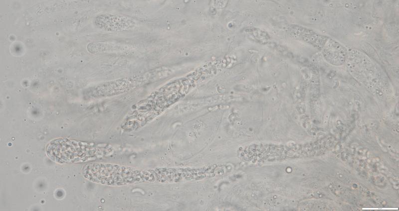 macrostoma