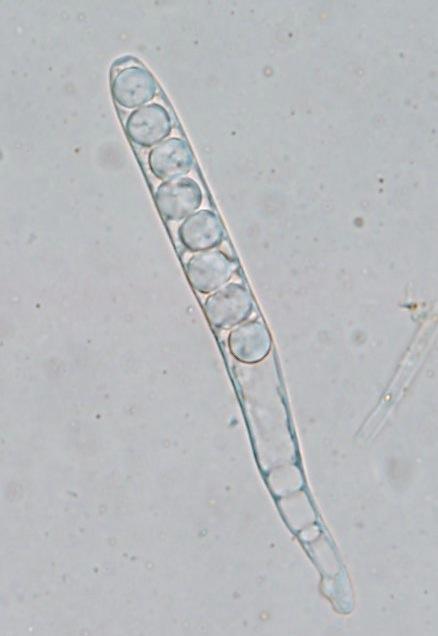 macrostoma