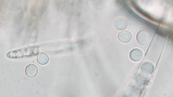 macrostoma