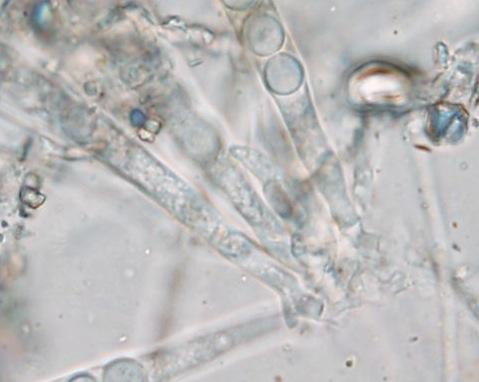 macrostoma