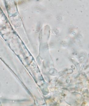 macrostoma