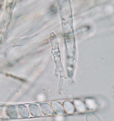 macrostoma