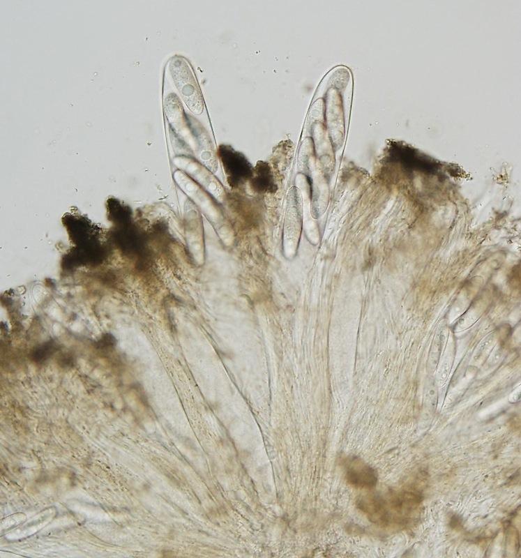 macrostoma
