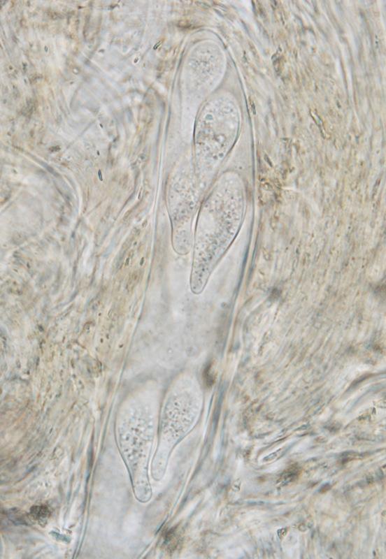 macrostoma
