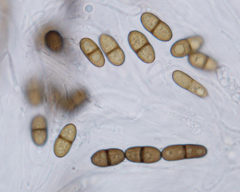 macrostoma