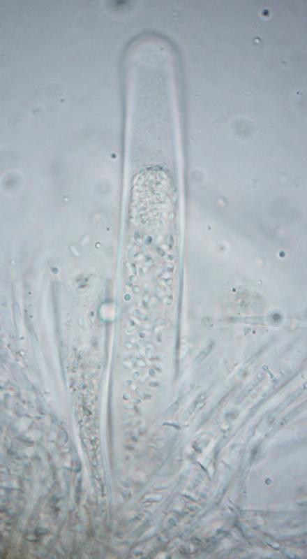 macrostoma