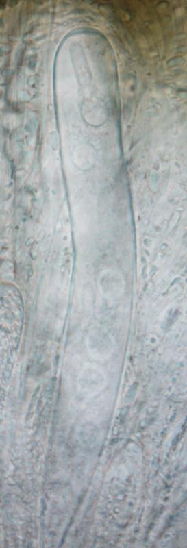 macrostoma