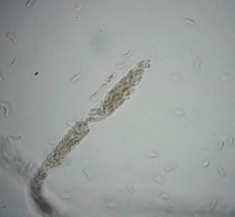 macrostoma