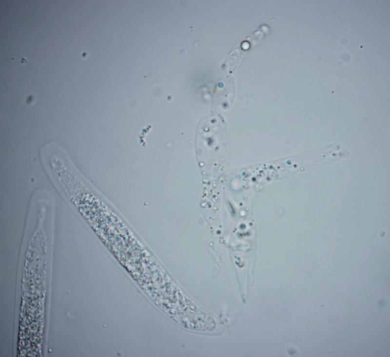 macrostoma