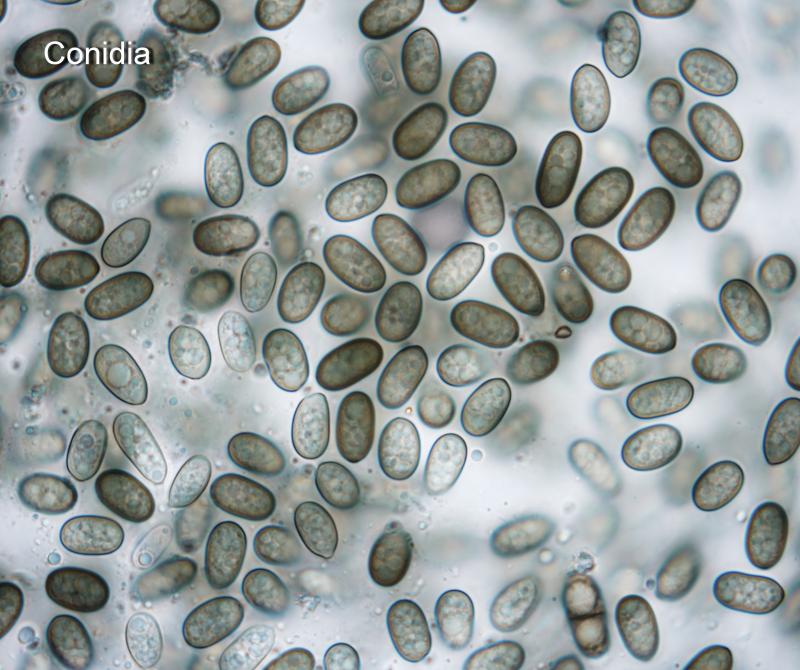 macrostoma