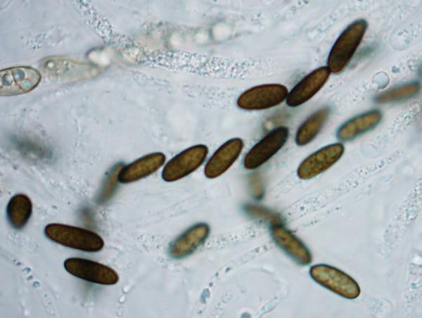 macrostoma