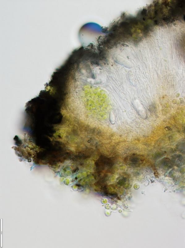 macrostoma