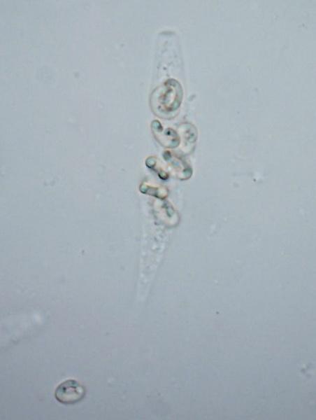 macrostoma
