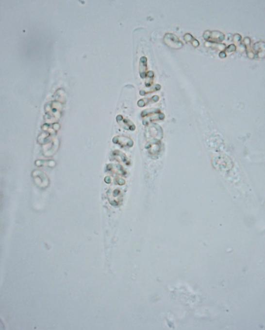 macrostoma