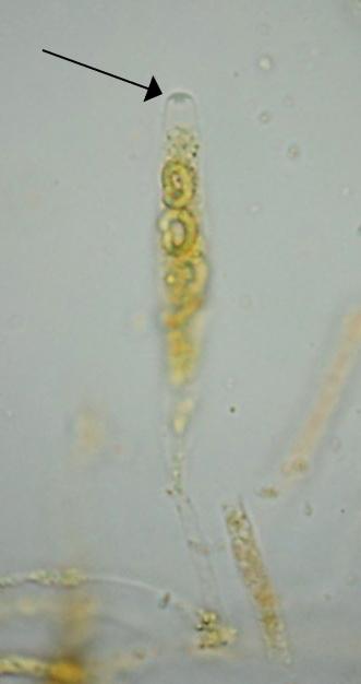 macrostoma