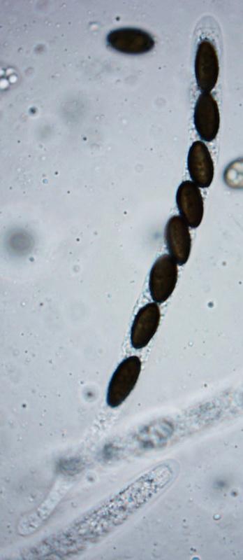 macrostoma