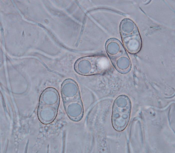 macrostoma