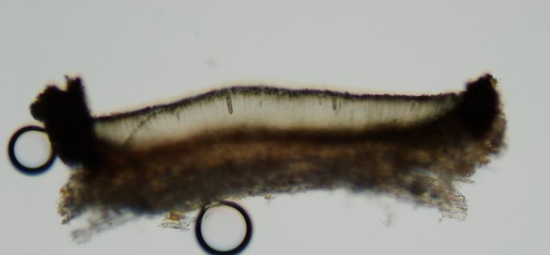 macrostoma