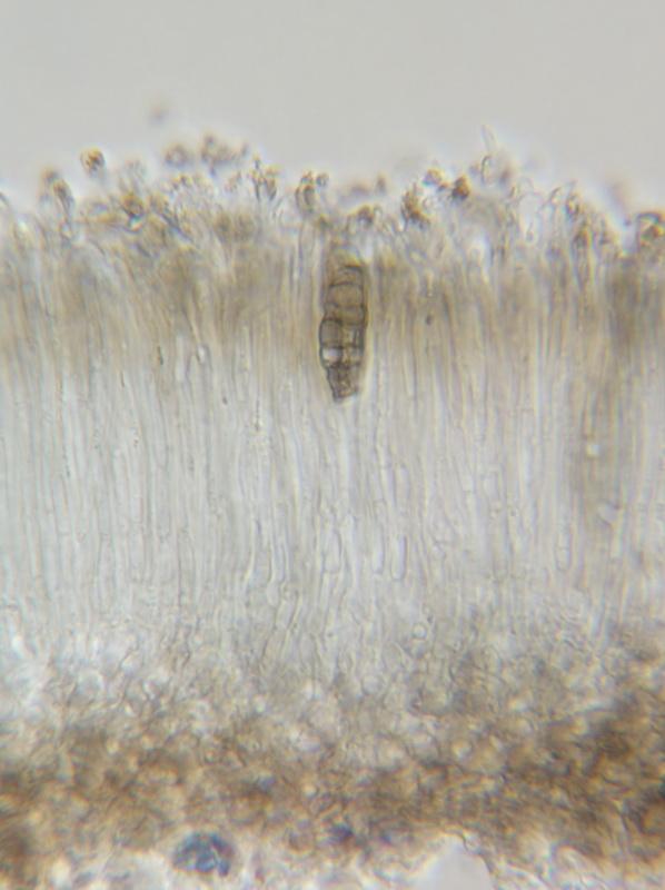 macrostoma