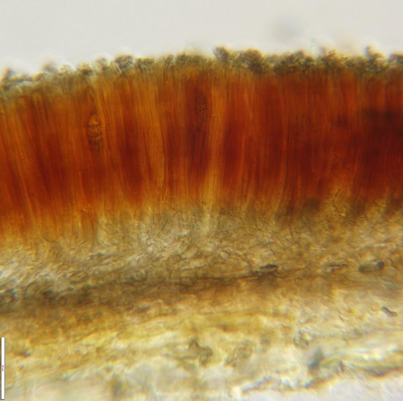 macrostoma