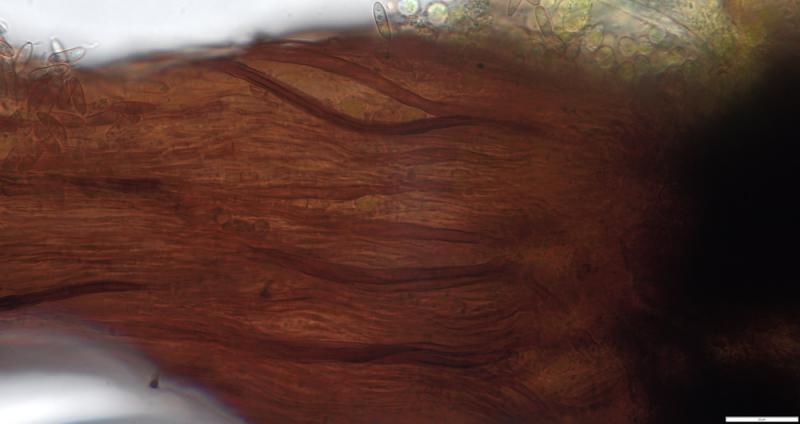 macrostoma