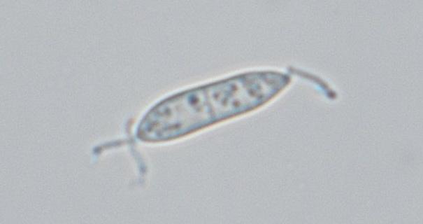 macrostoma