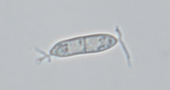 macrostoma