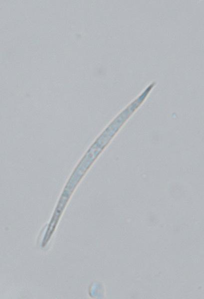 macrostoma
