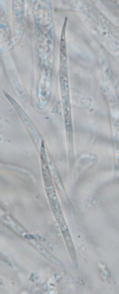 macrostoma
