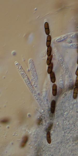macrostoma