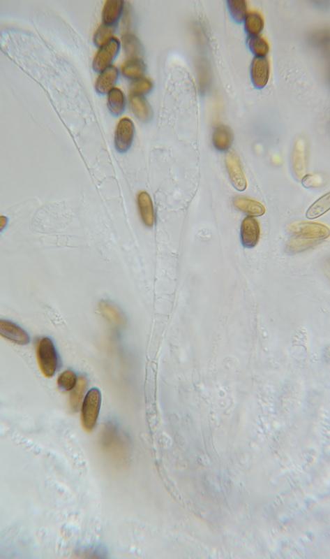 macrostoma