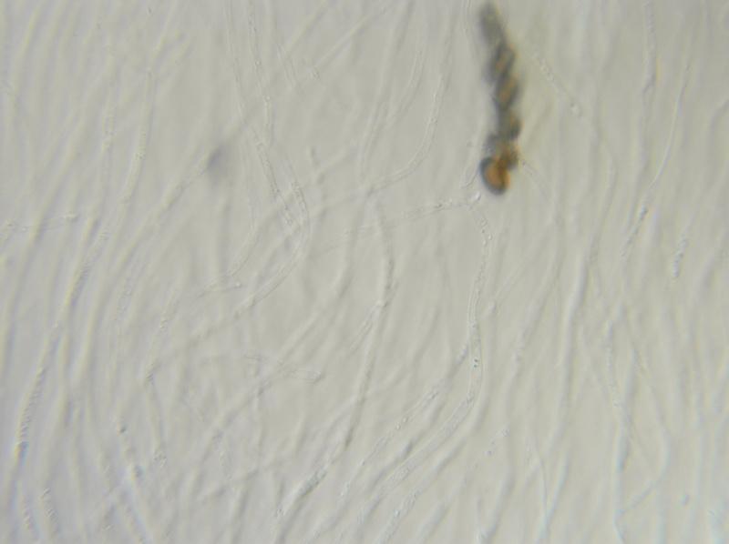 macrostoma