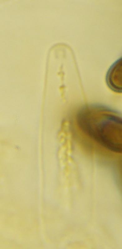 macrostoma
