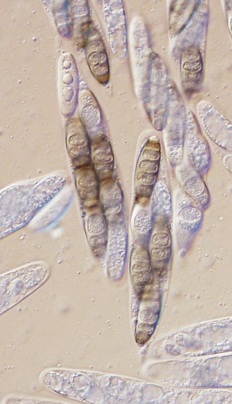 macrostoma