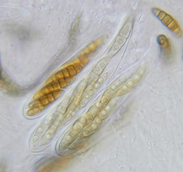 macrostoma