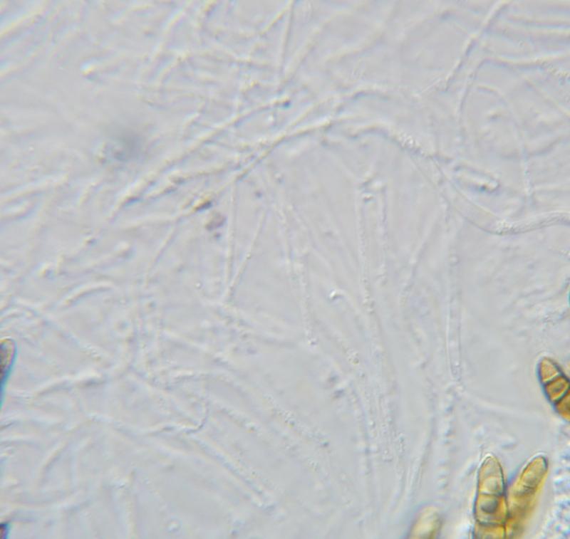 macrostoma