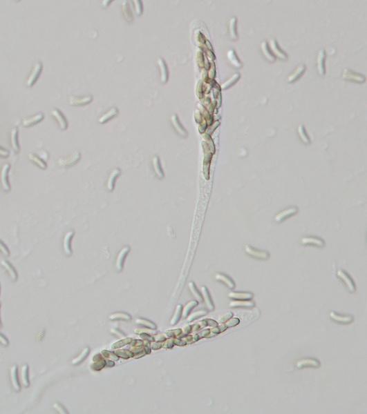 macrostoma