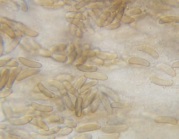 macrostoma