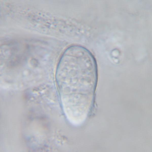macrostoma