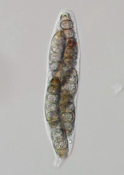 macrostoma