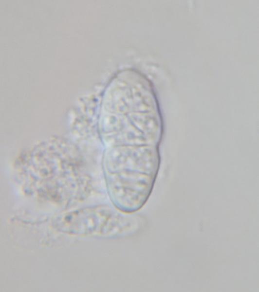 macrostoma