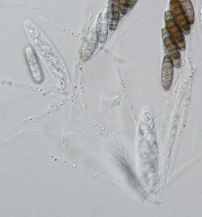 macrostoma