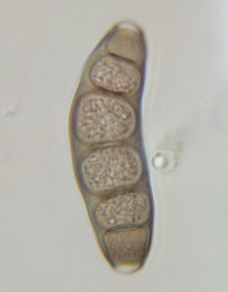 macrostoma