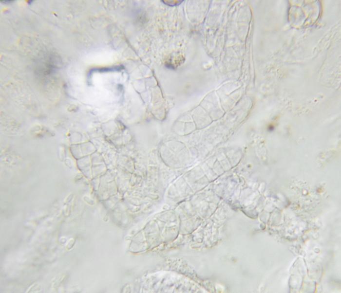 macrostoma