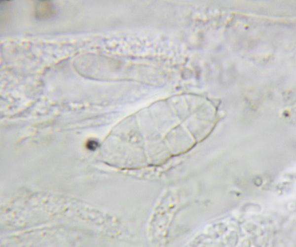 macrostoma