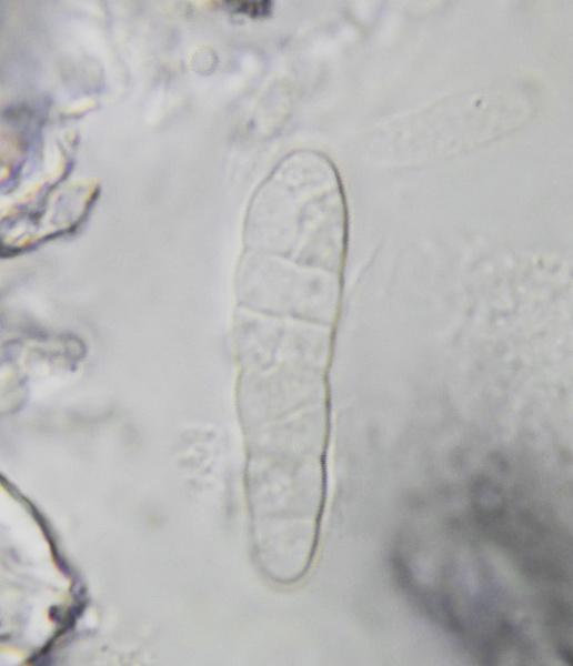 macrostoma