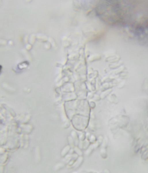 macrostoma